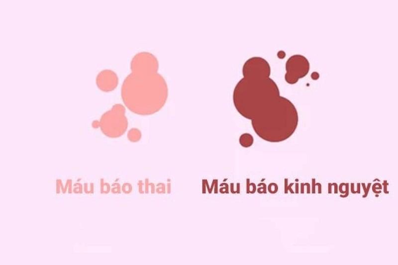 Máu báo thai là gì?