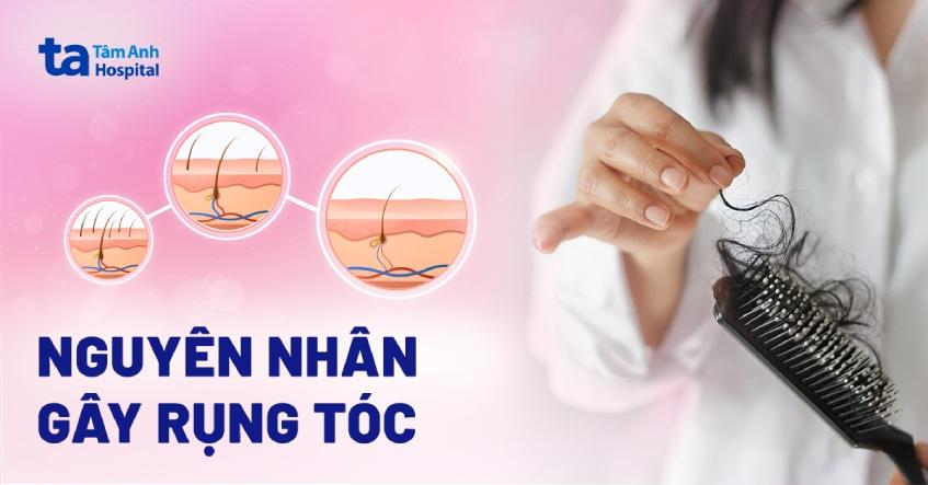 Rụng tóc là gì? 15 Nguyên nhân và dấu hiệu thường gặp