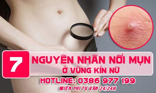 Top 7 nguyên nhân nổi mụn (mủ) ở vùng kín nữ