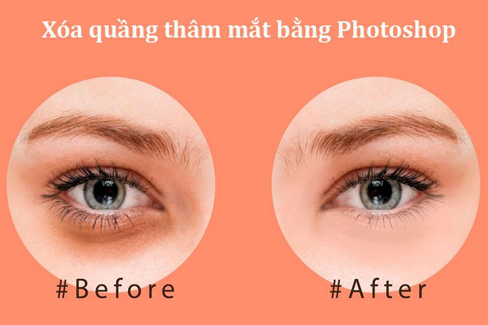 xóa quầng thâm mắt trong Photoshop