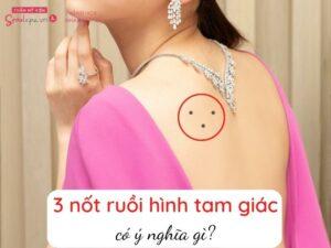 nốt ruồi hình tam giác