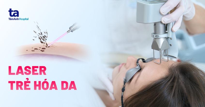 laser trẻ hóa da