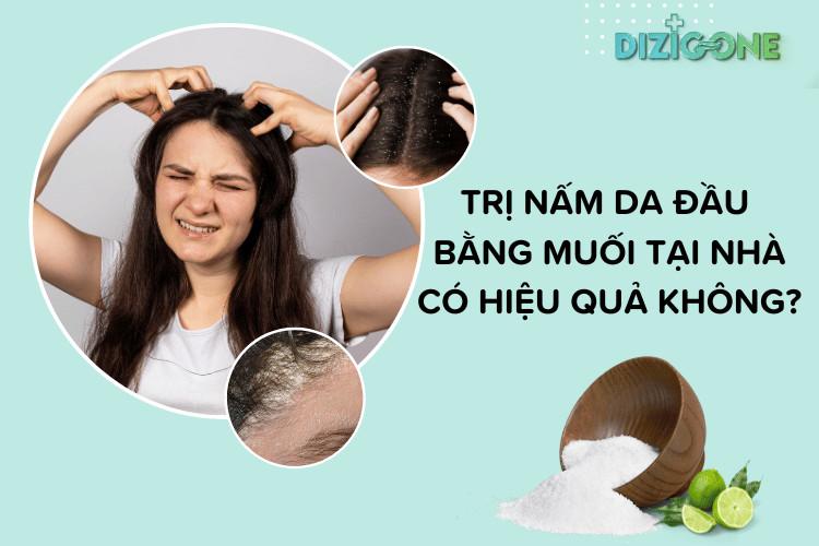 tri-nam-da-dau-bang-muoi trị nấm da đầu bằng muối