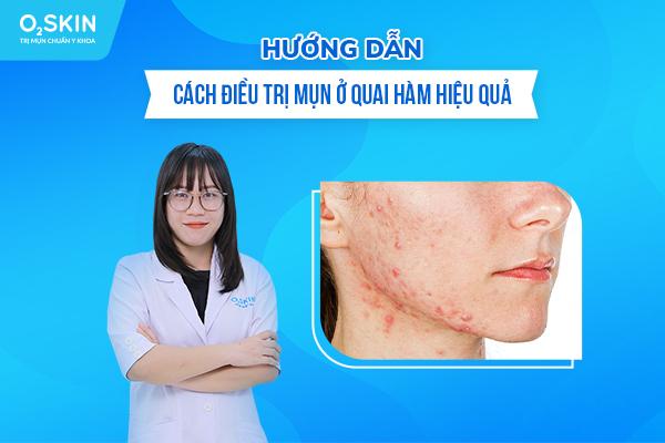 Mụn ở quai hàm nếu không điều trị có thể gây biến chứng viêm nhiễm