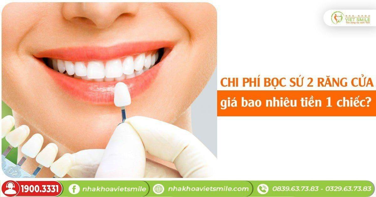 Chi phí bọc sứ 2 răng cửa giá bao nhiêu tiền 1 chiếc?