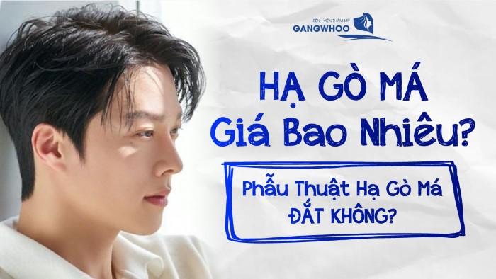 Hạ Gò Má Giá Bao Nhiêu? Chi Phí Quyết Định Bởi Các Yếu Tố?