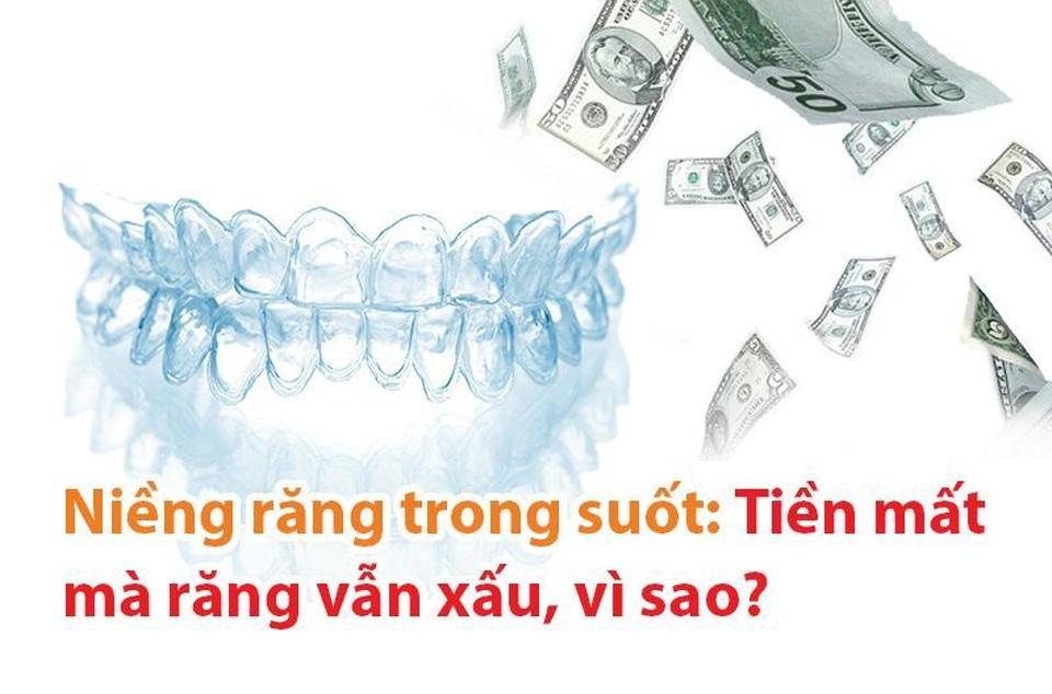 Niềng răng trong suốt: Tiền mất mà răng vẫn xấu, vì sao? - 1