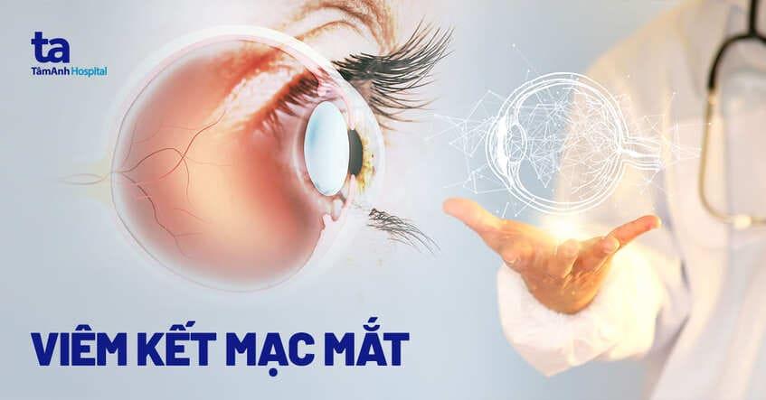 Viêm kết mạc