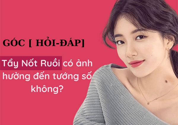 Tẩy nốt ruồi có ảnh hưởng đến tướng số không?