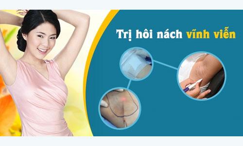 Cách chữa trị bệnh hôi nách vĩnh viện triệt để tận gốc tại nhà​