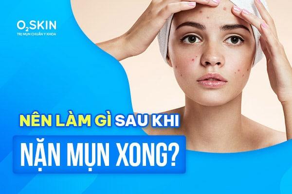 Nặn mụn xong nên làm gì để ngừa thâm tối đa?