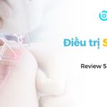 Điều trị sẹo lồi ở đâu? Review 6 địa chỉ uy tín tại Hà Nội